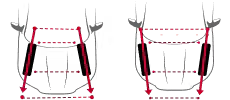 tire-alignment-edge-2