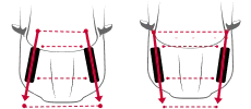 tire-alignment-edge-2